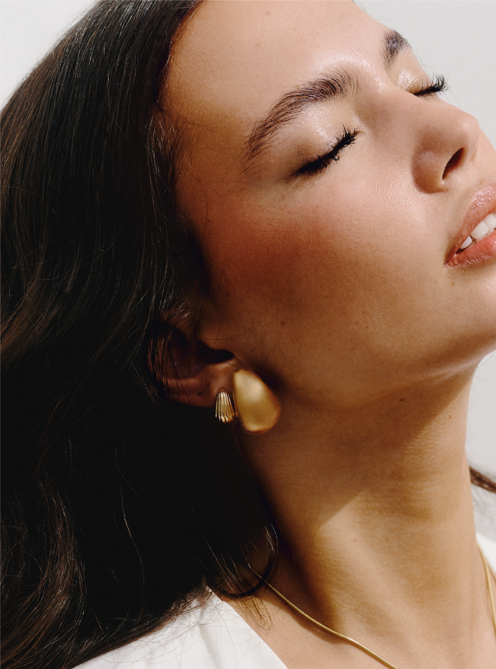 Aretes